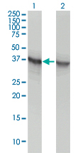 WB - ALDOA Antibody (monoclonal) (M02) AT1116a